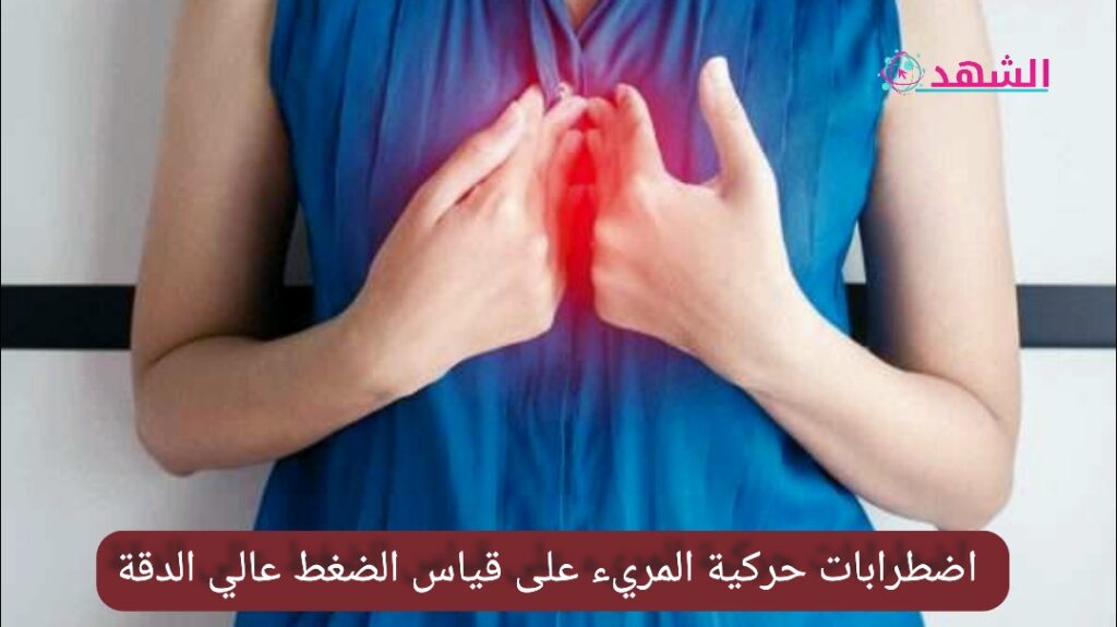 اضطرابات حركية المريء على قياس الضغط عالي الدقة