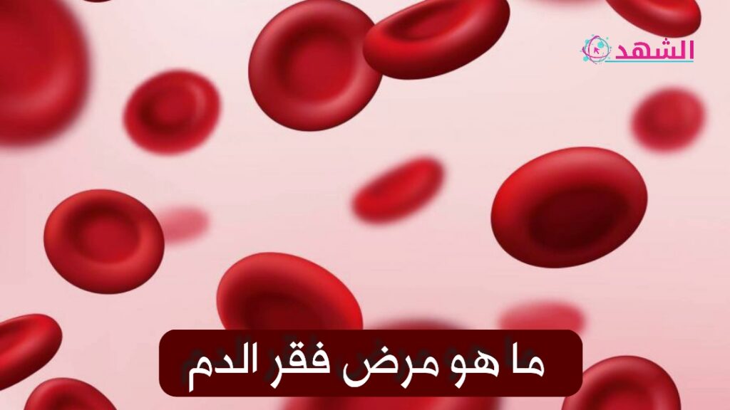 ما هو مرض فقر الدم
