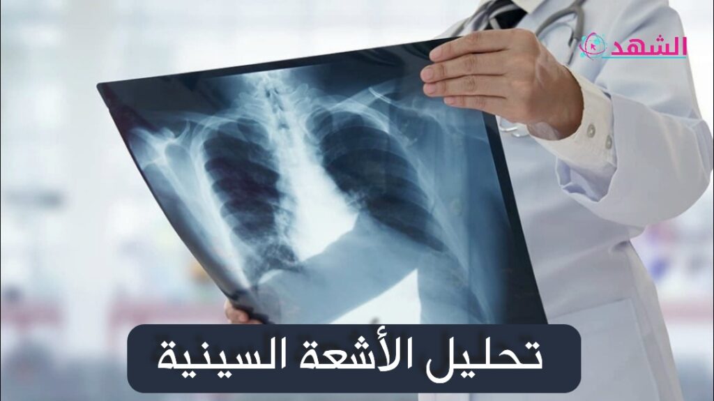 تحليل الأشعة السينية