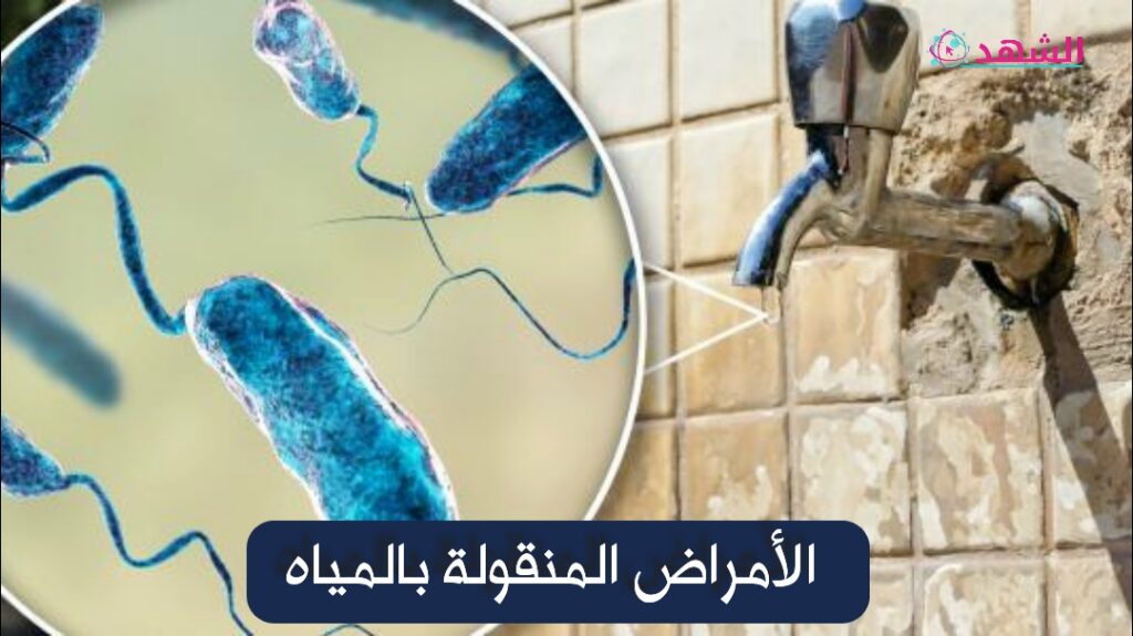 الأمراض المنقولة بالمياه