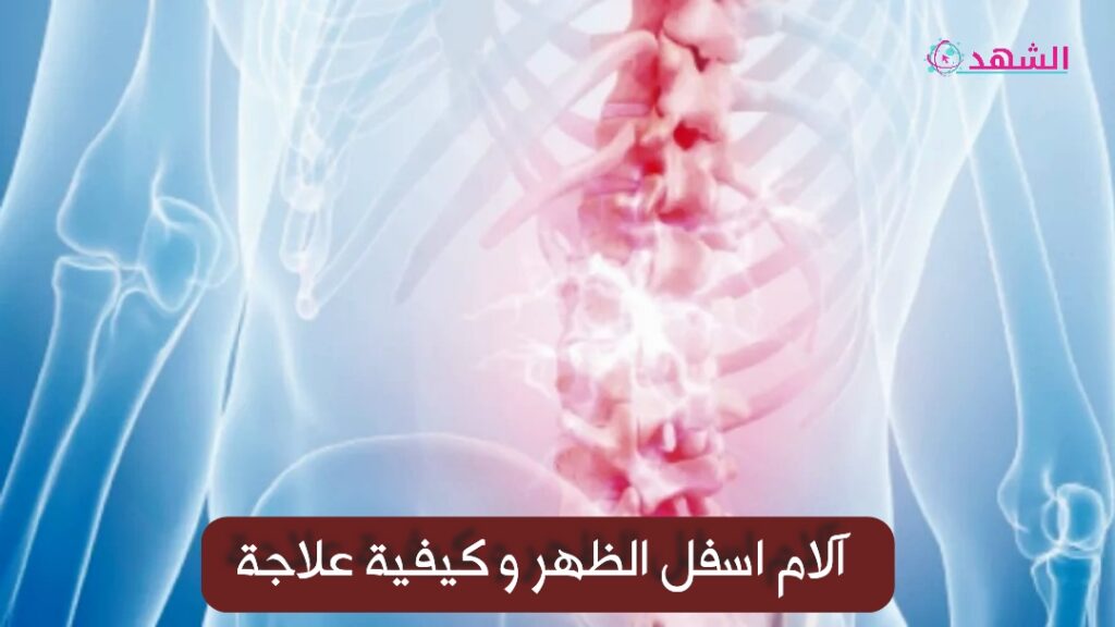 آلام اسفل الظهر و كيفية علاجة